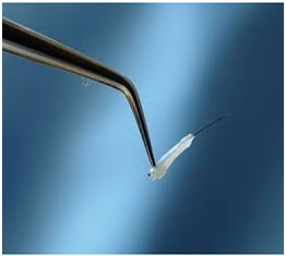 hair transplantation in vaishali nagar