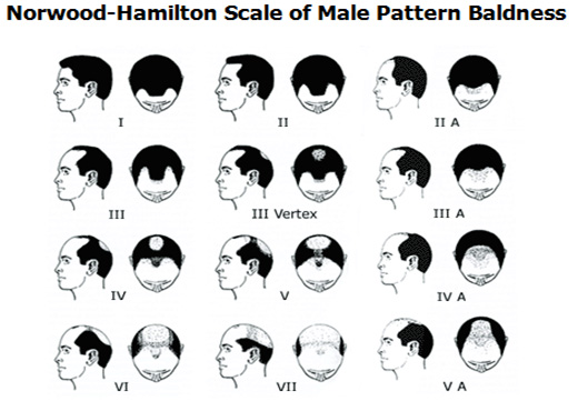 hair restoration treatment in vaishali nagar jaipur