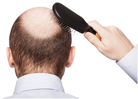 hair restoration treatment in jaipur