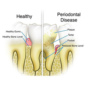 Best Dentist in Vaishali Nagar Jaipur