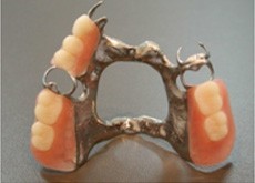 Prosthodontics Treatment Jaipur