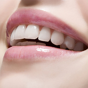 Best Dentist in Jaipur