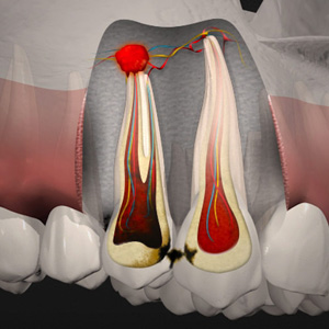 Best Dental Clinic in Vaishali Nagar Jaipur