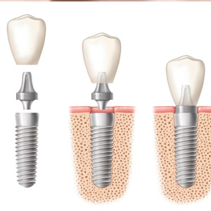 Best Dental Clinic in Jaipur