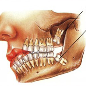 Dental Clinic in Vaishali Nagar Jaipur