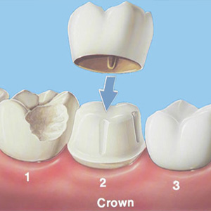 Dental Hospital in Jaipur